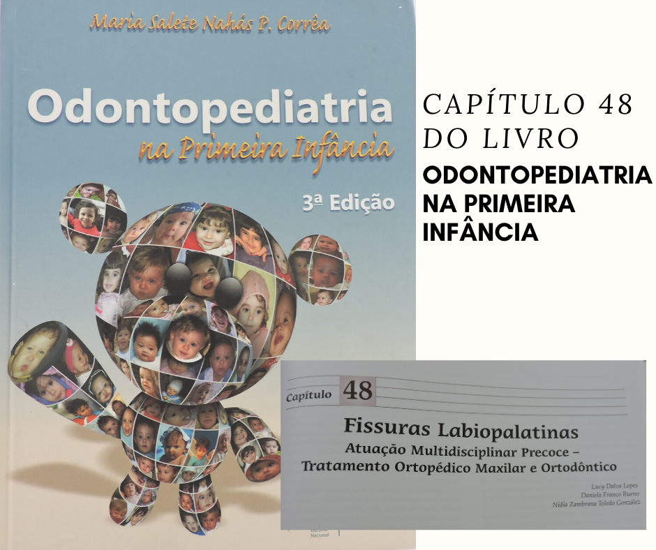 Odontopediatria na primeira infância_capítulo 48