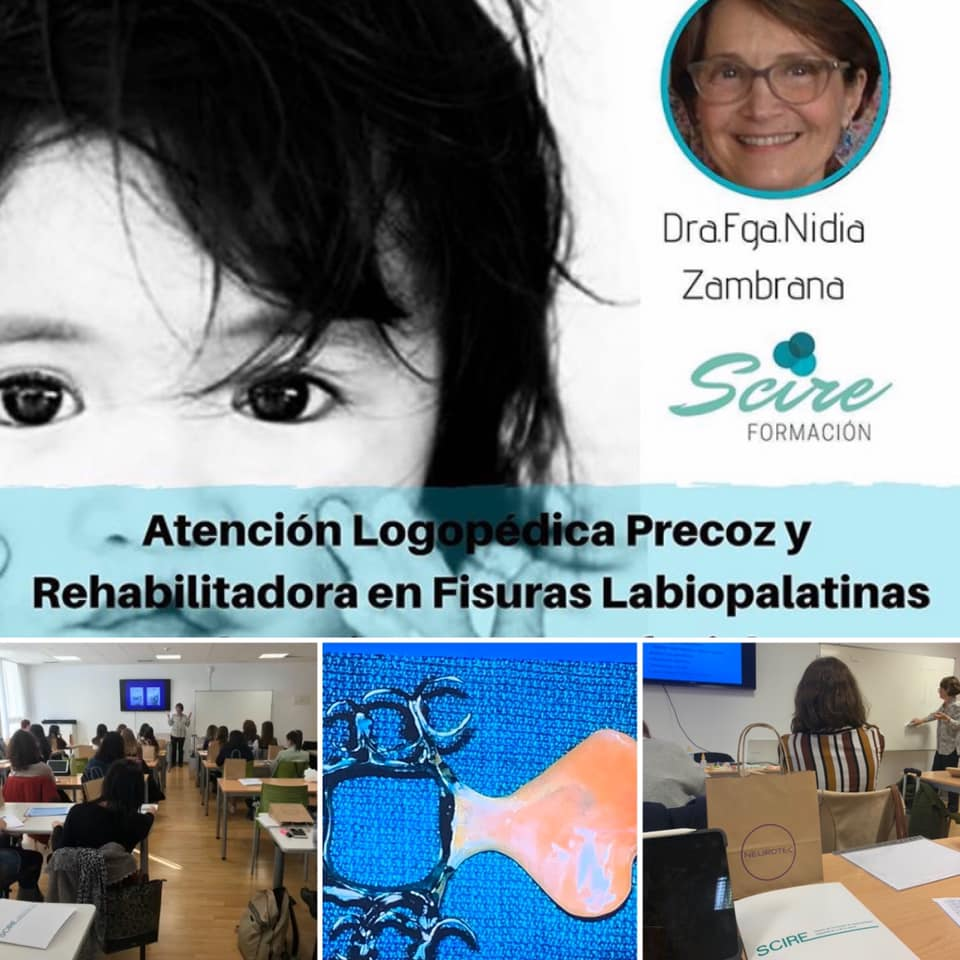 Curso Fissuras Labiopalatinas - Valencia 2020.png