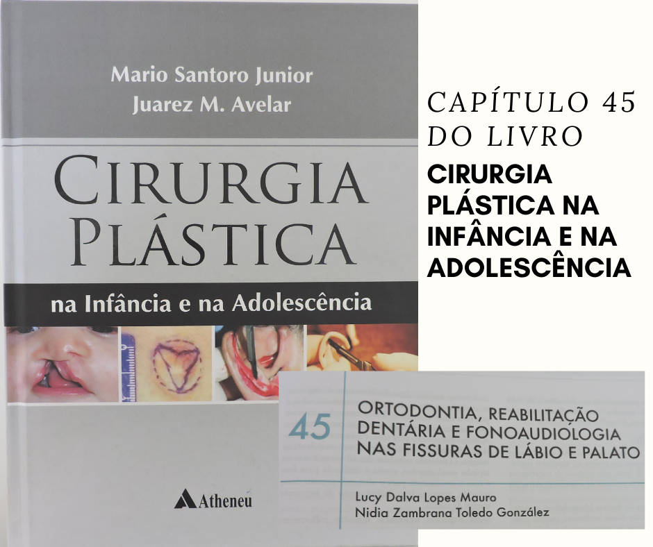 Cirurgia Plástica na Infância e na Adolescência_Capítulo 45